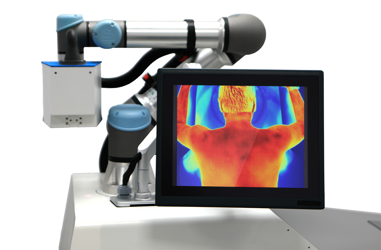Thermographic reading showing thermal asymmetry of the back